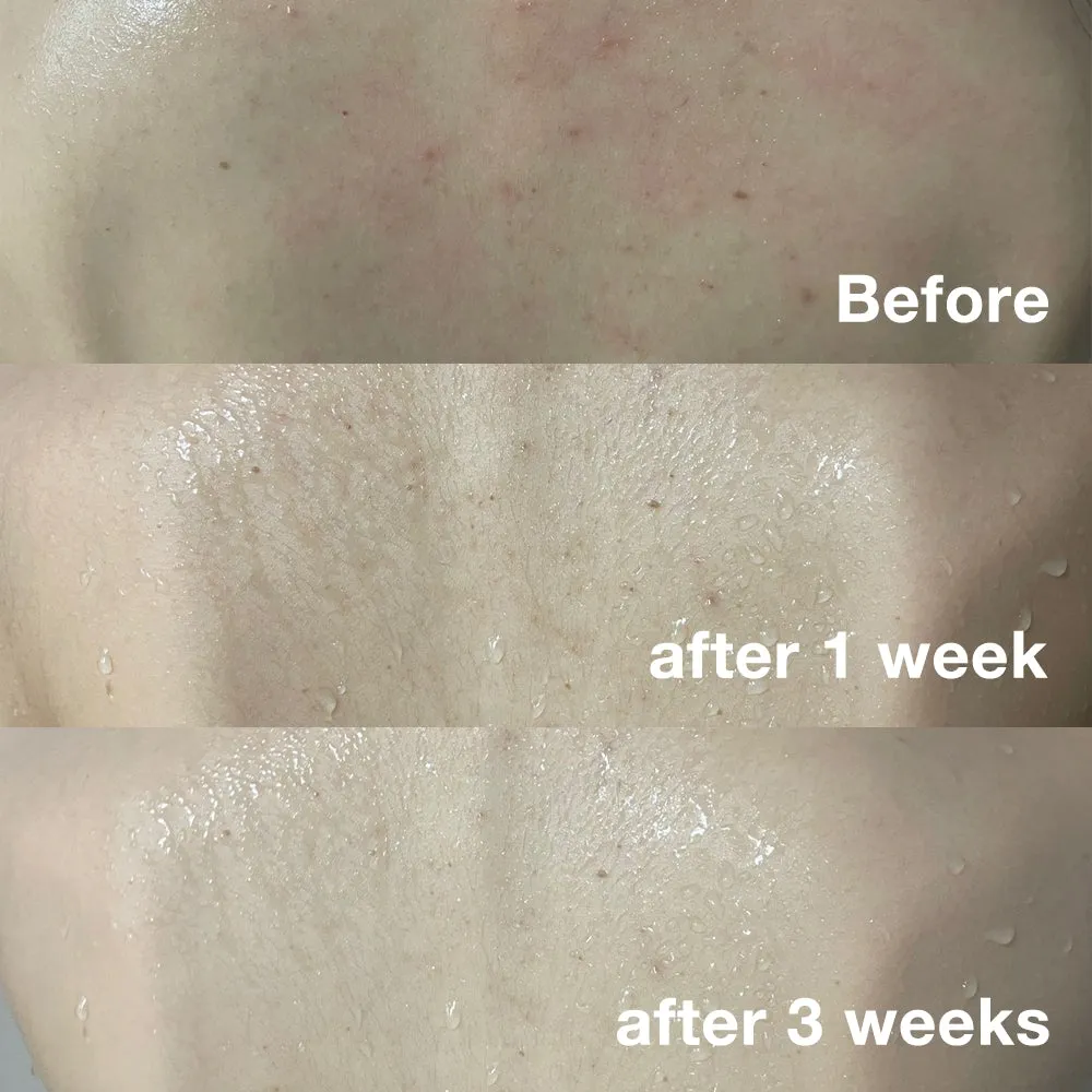 [M-CLUB] Red Line Total Care SET (Face & Body)
