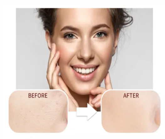 Matte My Day Face Primer - MQO 25 pcs