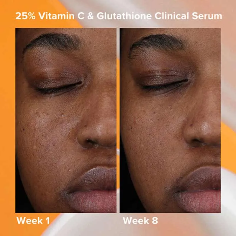 Paula's Choice 25% Vitamin C   Glutathione Clinical Serum