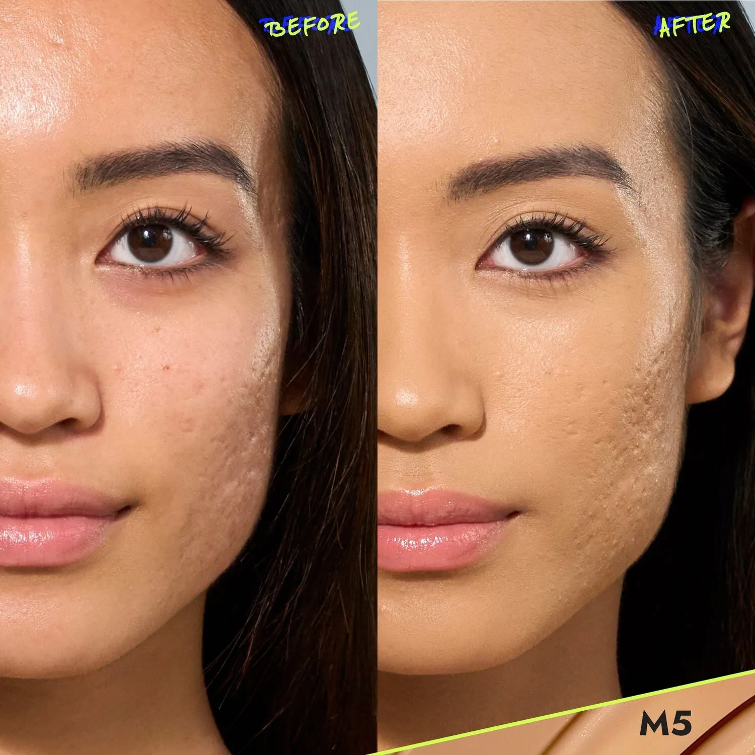 The Fine Lines & Wrinkles Duo